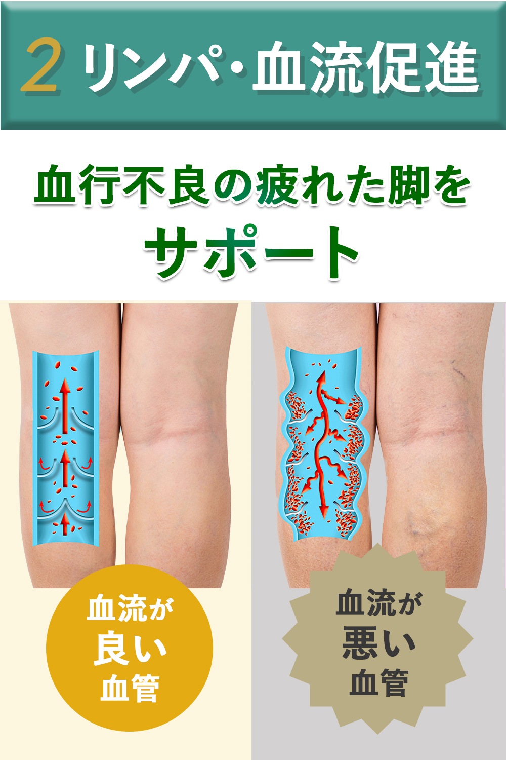 ソックス 選べる3タイプ ベージュ 男女兼用 締メディカル 一般医療機器【ふくらはぎサポーター／つま先なし(オープントゥ)／つま先あり】