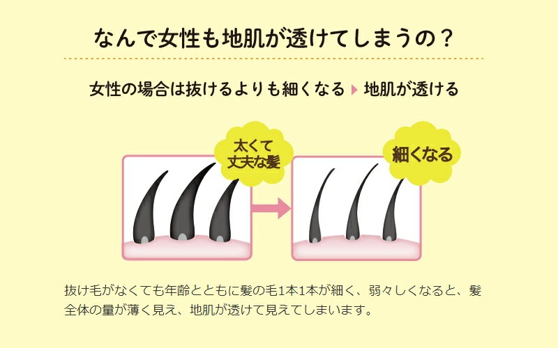 育毛剤 ノンシリコン 植物生まれ（オレンジ） 植物生まれの薬用育毛美容液 180ml 育毛美容液 正規品 オーガニック 無添加 石澤研究所 ヘアケア 頭皮ケア ノンパラベン 低刺激 頭皮ケア 頭皮化粧水