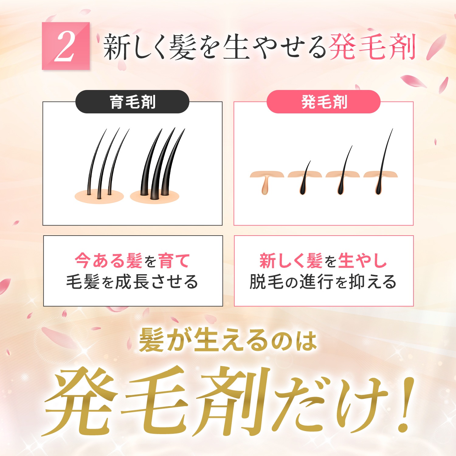 【第1類医薬品】MXプラスローションLa 60ml ミノキシジル 女性 ミノキシジル1% 医薬品 市販 発毛剤 女性用 40代 50代 60代