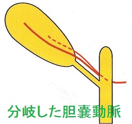 ��ǹ��ǥ롡������