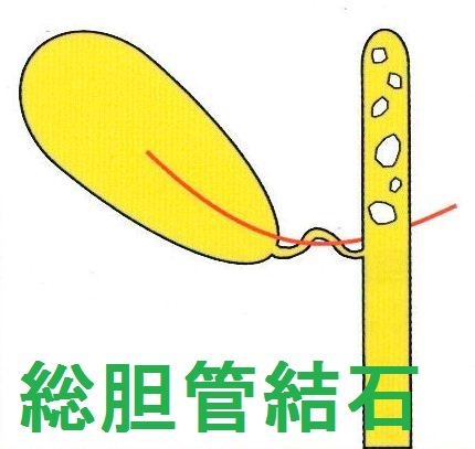 ��ǹ��ǥ롡������