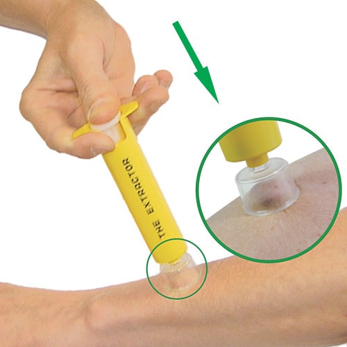 アスピラボ ポイズンリムーバー AP01100000 アスピラボエクストラクターポイズンリムーバー 蜂 ハチ 毒虫 応急処置 飯塚カンパニー正規取扱店 ドクターヘッセル/Dr.Hessel's