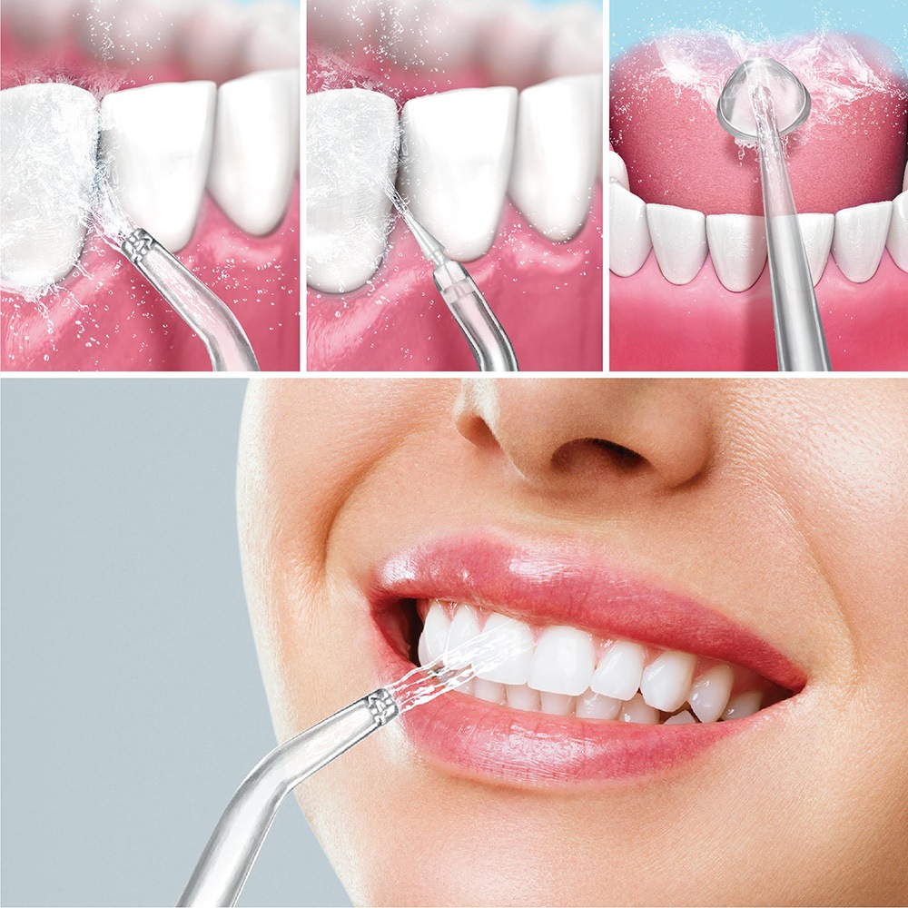 AXEL アクセル 口腔洗浄器 ジェットケア アルファ AXL-532 | 全商品