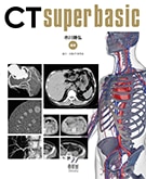 CT super basic