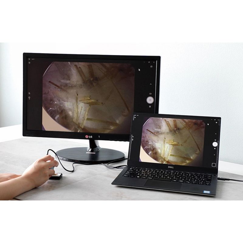 スリーアール  【デジタル顕微鏡】 マジックルーペアール