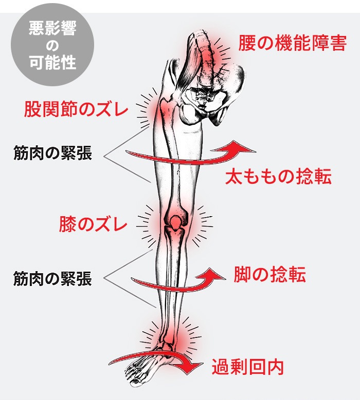 ������ ARCHIES ���������� ���������ݡ��ȥ��饤�ɥ������