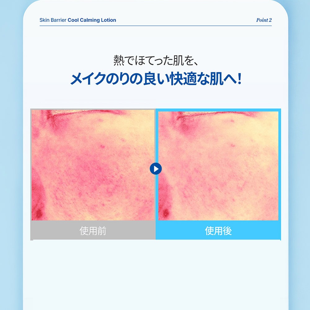 【新発売】スキンバリアクールCローション (100ml) Skin Barrier Cool CalmingLotion