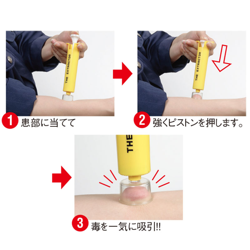 アスピラボ エクストラクター毒を一気に吸引