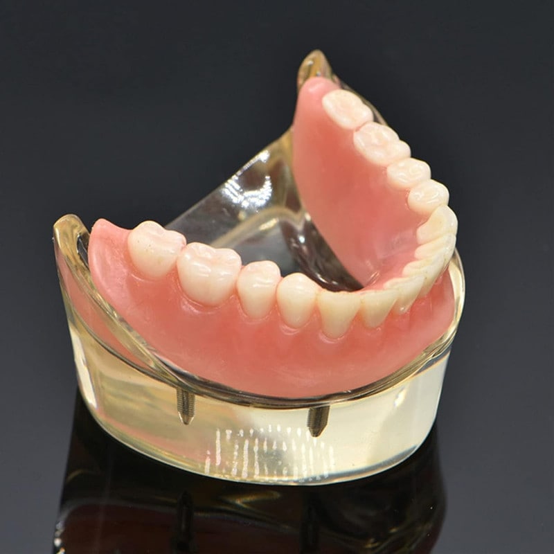 歯列模型 歯科修復モデル