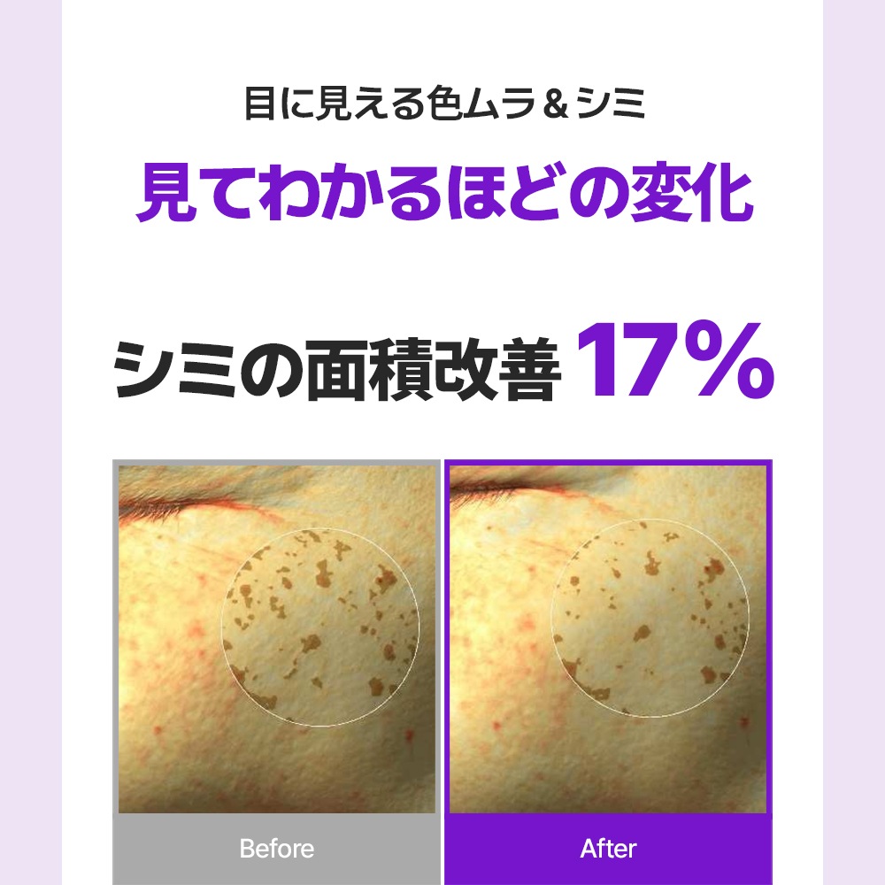 Dr.Viuum GLUTACICA MELASMA CREAM  Ź M꡼ 륿 륿   ߥ辰  ò꡼ ۥ磻ȥ꡼  륿  ߥ ɥӥ