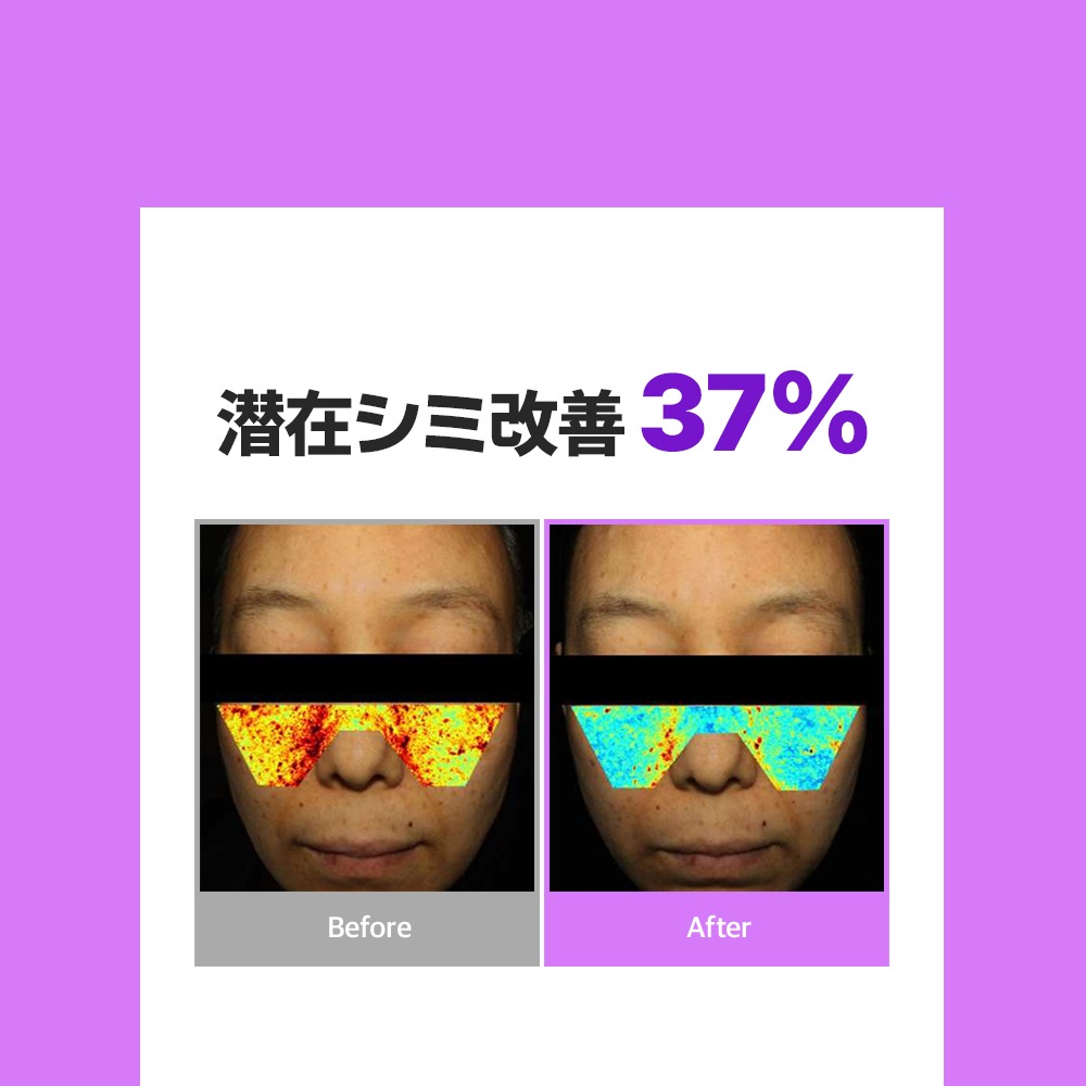 Dr.Viuum GLUTACICA MELASMA CREAM  Ź M꡼ 륿 륿   ߥ辰  ò꡼ ۥ磻ȥ꡼  륿  ߥ ɥӥ