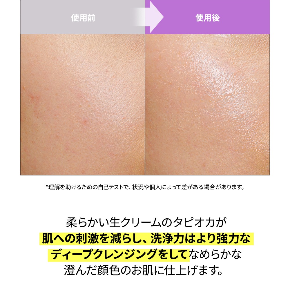 Dr.Viuum GLUTACICA VITA TONING CLEANSING FOAMŹ 󥸥󥰥եࡡ륿 ӥߥ󡡥ȡ˥󥰡󥶡šɥӥࡡҴȩɷ