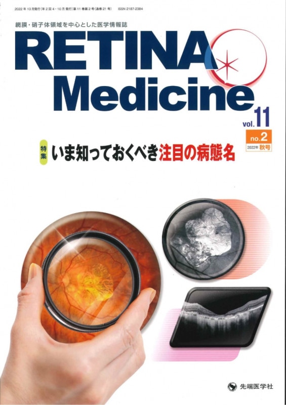 Retina Medicine