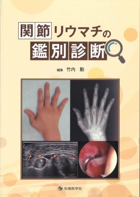 運動器外傷治療学 運動器外傷治療学 | 書籍詳細 | 書籍 | 医学書院