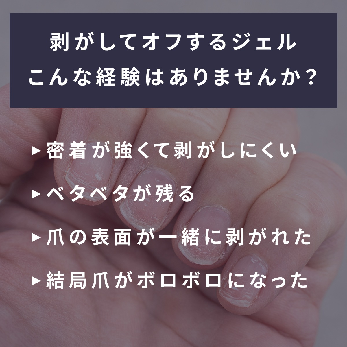 SHINYGEL Mio：ピールオフリムーバー〈ピールベース用リムーバー〉（シャイニージェルミオ）／純国産 日本製 $