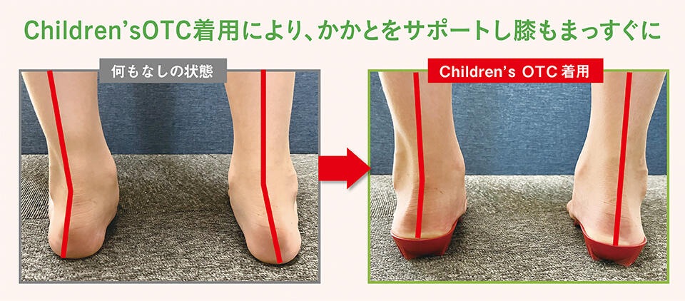 サポートインソール チルドレンズOTC キッズ ジュニア 中敷き NWPL社 足の動きに安定性を与える後足部サポート