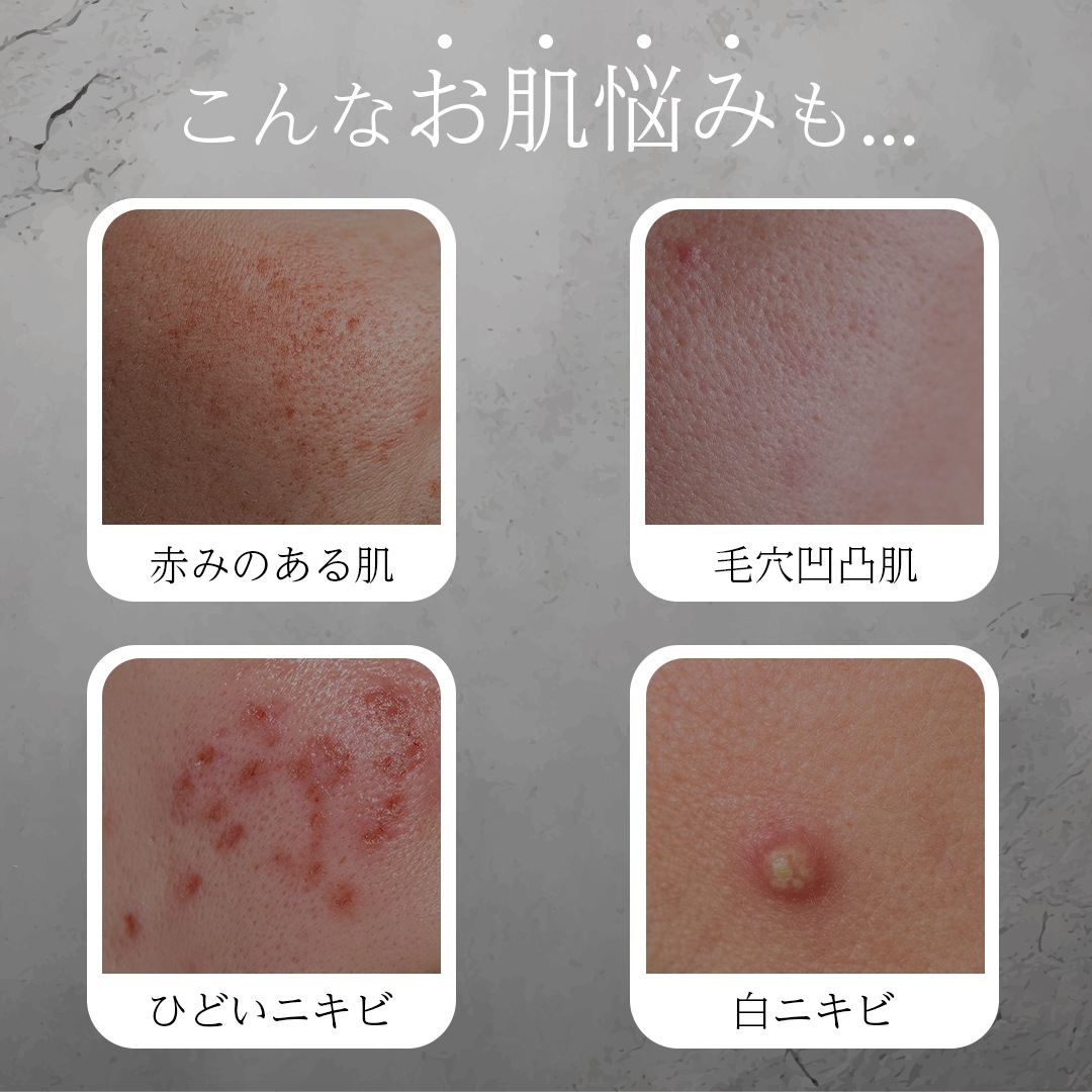 ֥ΥåȥȥޥåȥåCathyDollʥ㥷ɡ