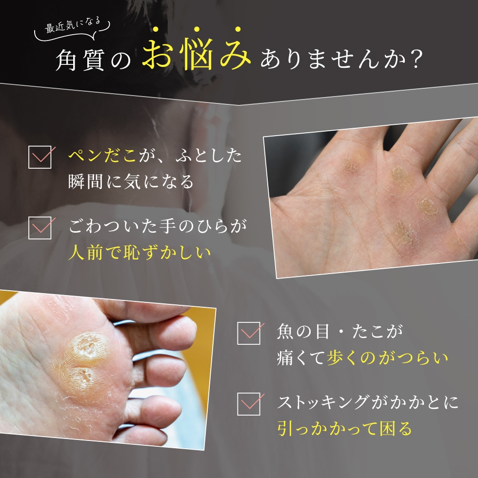 【ネコポス対応】角質ケアスティック SILHEAL(シルヒール)