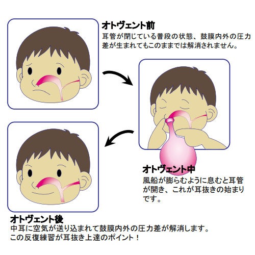 OTOVENT/H�ʥ��ȥ�����ȡ� 6001 ���ȥ������ �Ρ����ԡ���1�� + �Х롼��5�� ��ȴ�� ���� �����ӥ�