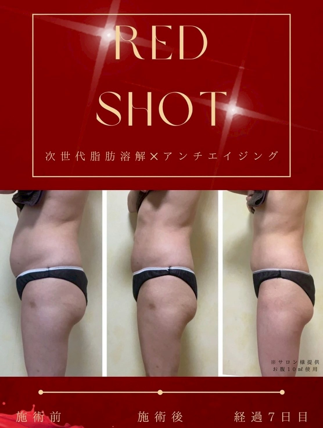 RED SHOT (レッドショット)