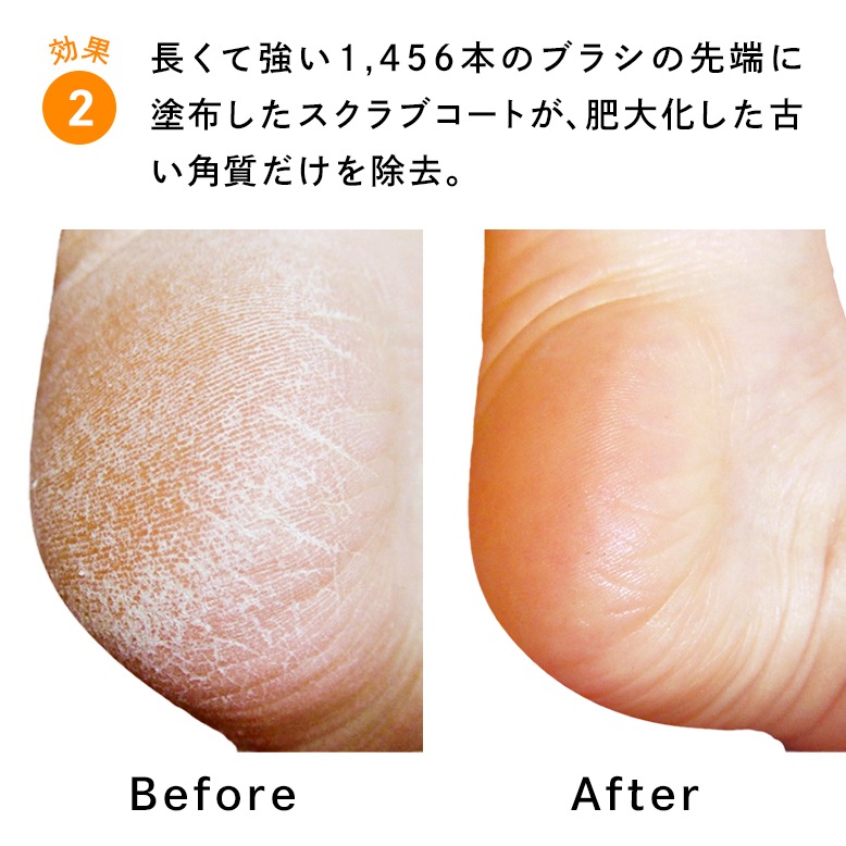 【10個セット】フットグルーマーグラン