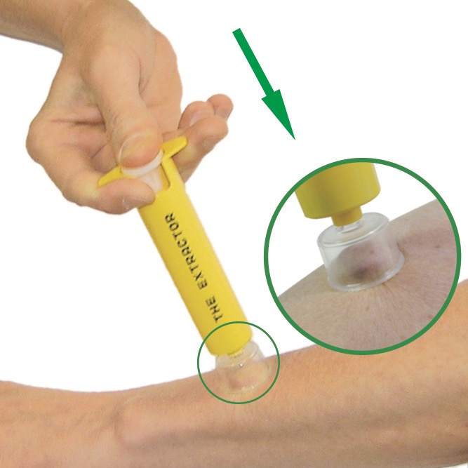 �������ȥ饯�����ݥ������ࡼ�С�