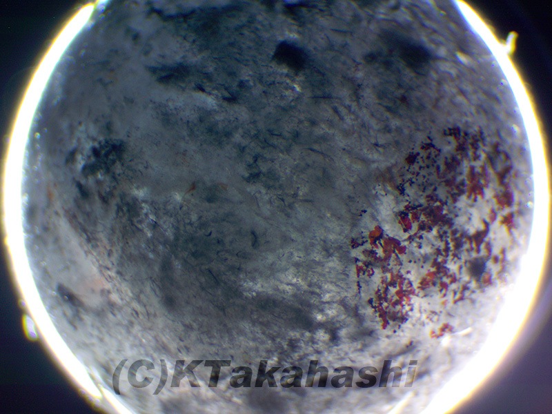 졼徽Υ֥쥹åȡ10mm