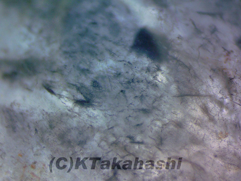 졼徽Υ֥쥹åȡ10mm