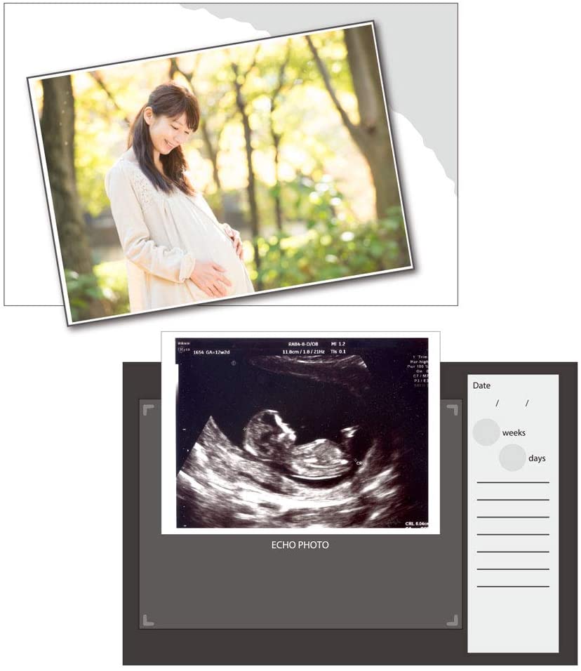 エコー写真の収納にサンスター文具エコー写真アルバム＆mom ＤＣ　ベビーミッキー＆フレンズS2167840母子手帳ケースに入ります