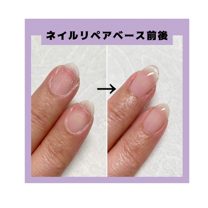 ネイルパフェ ネイルリペアベース 10g【109865】 | 美容ケア/ネイル