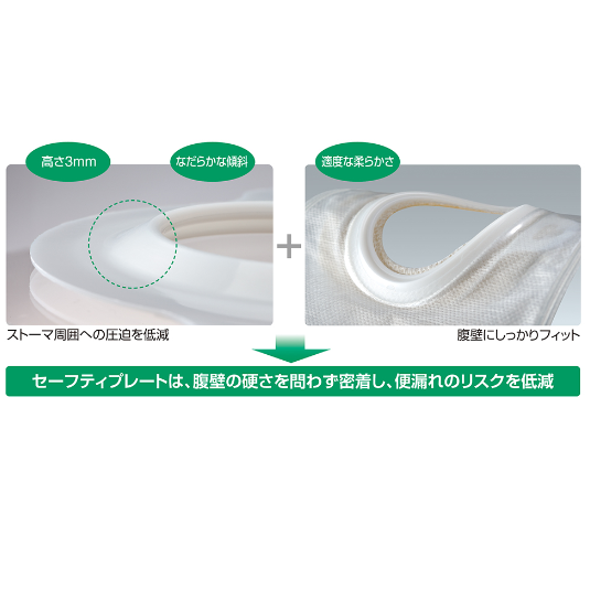 ユーケアー・TDs 20ストーマ有効径14～19mm