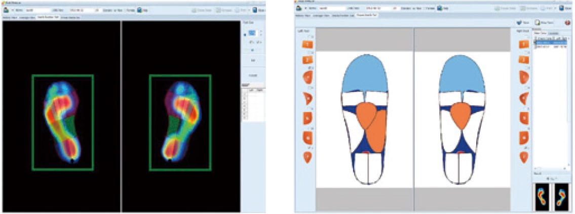 フットチェッカー Foot Checker｜足底圧と重心バランスをリアルタイム表示・姿勢改善・転倒予防に貢献するコンパクト足圧測定器【介護・フィットネス・リハビリ施設で活躍】