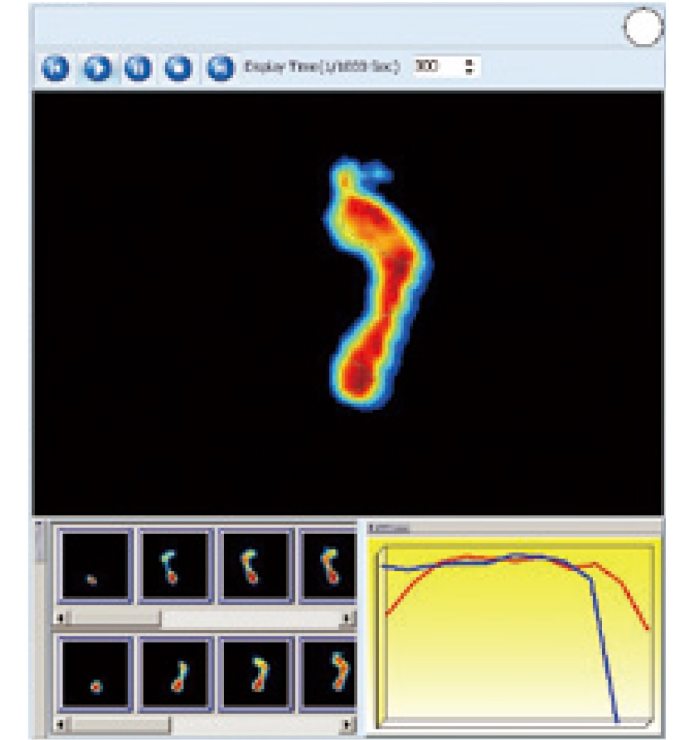 フットチェッカー Foot Checker｜足底圧と重心バランスをリアルタイム表示・姿勢改善・転倒予防に貢献するコンパクト足圧測定器【介護・フィットネス・リハビリ施設で活躍】