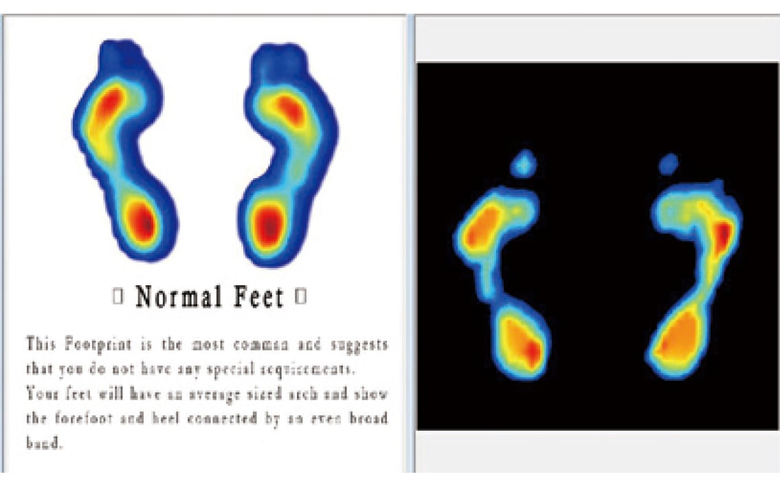 フットチェッカー Foot Checker｜足底圧と重心バランスをリアルタイム表示・姿勢改善・転倒予防に貢献するコンパクト足圧測定器【介護・フィットネス・リハビリ施設で活躍】