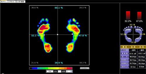 TRUEfeet（トゥルーフィート） 足指アーチ・足裏バランス・姿勢補正をサポートするフットケアツール｜正しい足の使い方を習慣化し、足裏から全身の健康へアプローチ【特許出願中】