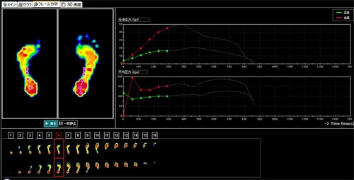 TRUEfeet（トゥルーフィート） 足指アーチ・足裏バランス・姿勢補正をサポートするフットケアツール｜正しい足の使い方を習慣化し、足裏から全身の健康へアプローチ【特許出願中】