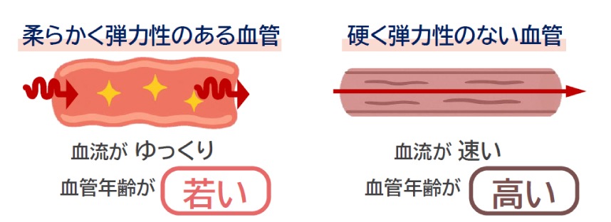 血管年齢測定器 iheart｜約30秒で血管年齢・血流状態を見える化｜指先クリップ式・非侵襲測定｜健康経営・健康イベント・薬局・高齢者施設向け