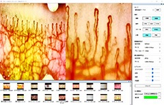 高性能血流スコープ TOKU Capillaro｜卓上＆ハンディ兼用｜最大510倍ズーム・USB接続・5モード搭載・指先/肌/頭皮の血流観察に対応・手振れ防止＆映像計測ソフト付き【日本製】
