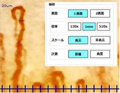 高性能血流スコープ TOKU Capillaro｜卓上＆ハンディ兼用｜最大510倍ズーム・USB接続・5モード搭載・指先/肌/頭皮の血流観察に対応・手振れ防止＆映像計測ソフト付き【日本製】