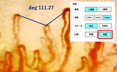 高性能血流スコープ TOKU Capillaro｜卓上＆ハンディ兼用｜最大510倍ズーム・USB接続・5モード搭載・指先/肌/頭皮の血流観察に対応・手振れ防止＆映像計測ソフト付き【日本製】