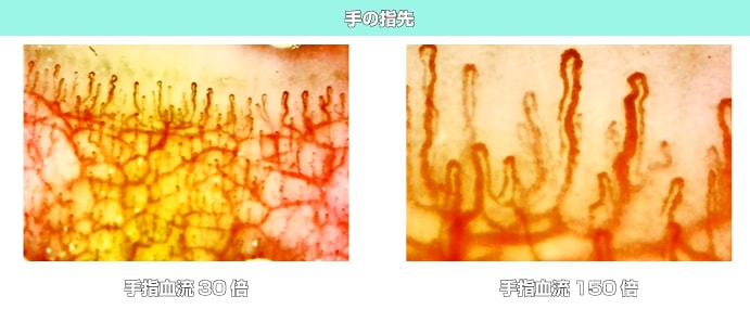 高性能血流スコープ TOKU Capillaro｜卓上＆ハンディ兼用｜最大510倍ズーム・USB接続・5モード搭載・指先/肌/頭皮の血流観察に対応・手振れ防止＆映像計測ソフト付き【日本製】