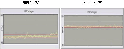 血管年齢・ストレス測定器 ボディチェッカー【一般医療機器・クラスⅠ】加速度脈波＆心拍間変異測定｜左手指先だけで自律神経バランスと血管老化度を簡単チェック｜レンタル対応可・イベント・施設向けに最適