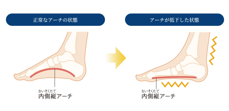 ファイテン ソラーチ｜中足骨マッサージ式フットマッサージャー｜疲労回復・血行促進・足裏ケア｜卓上型足裏マッサージ器