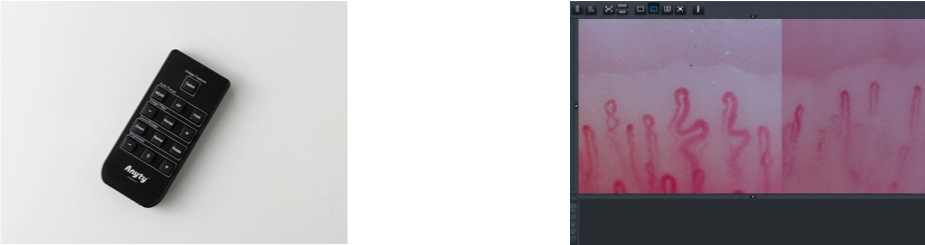 血流ドクターオート 3R-DRAUTO｜高速オートフォーカス搭載のハンディ血流観察機器｜高精細フルHD画質・約2秒で自動ピント調整｜軽量設計で省スペース・美容・健康カウンセリングに最適