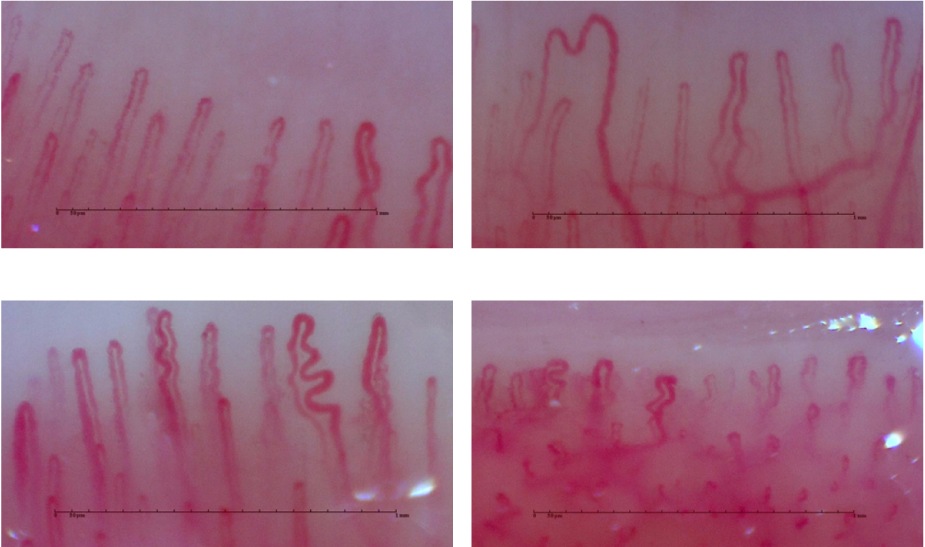 血流ドクターオート 3R-DRAUTO｜高速オートフォーカス搭載のハンディ血流観察機器｜高精細フルHD画質・約2秒で自動ピント調整｜軽量設計で省スペース・美容・健康カウンセリングに最適