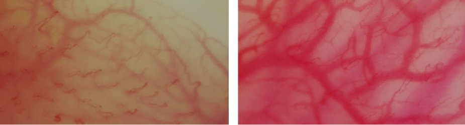 血流ドクターオート 3R-DRAUTO｜高速オートフォーカス搭載のハンディ血流観察機器｜高精細フルHD画質・約2秒で自動ピント調整｜軽量設計で省スペース・美容・健康カウンセリングに最適