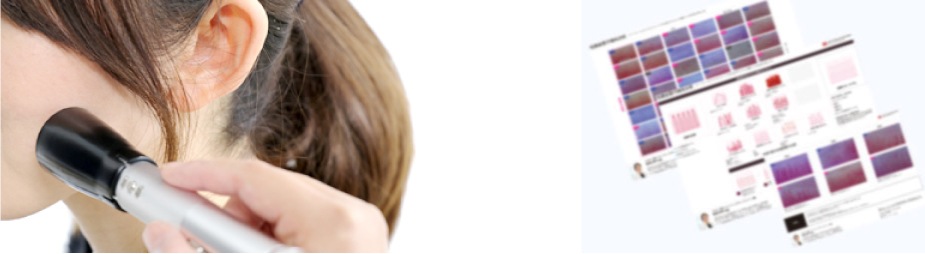 血流ドクターオート 3R-DRAUTO｜高速オートフォーカス搭載のハンディ血流観察機器｜高精細フルHD画質・約2秒で自動ピント調整｜軽量設計で省スペース・美容・健康カウンセリングに最適