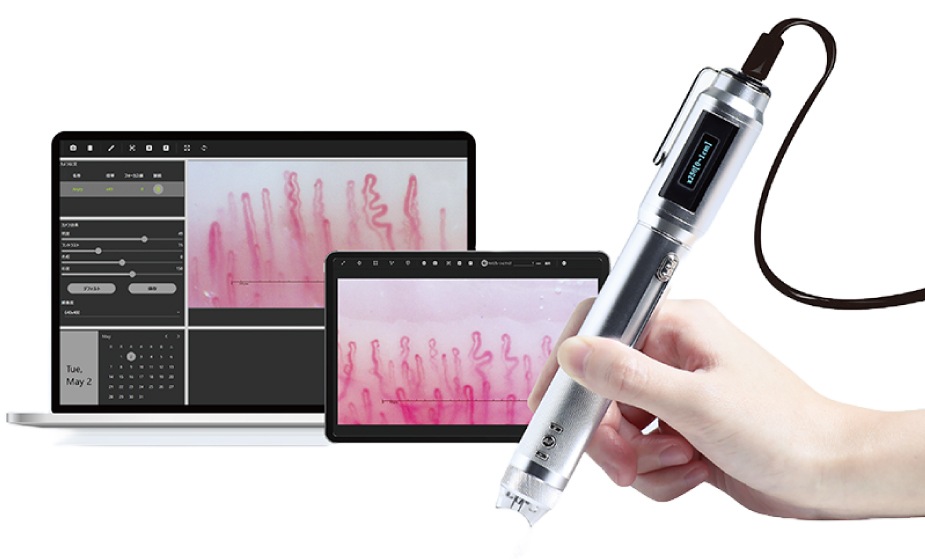 血流ドクターオート 3R-DRAUTO｜高速オートフォーカス搭載のハンディ血流観察機器｜高精細フルHD画質・約2秒で自動ピント調整｜軽量設計で省スペース・美容・健康カウンセリングに最適