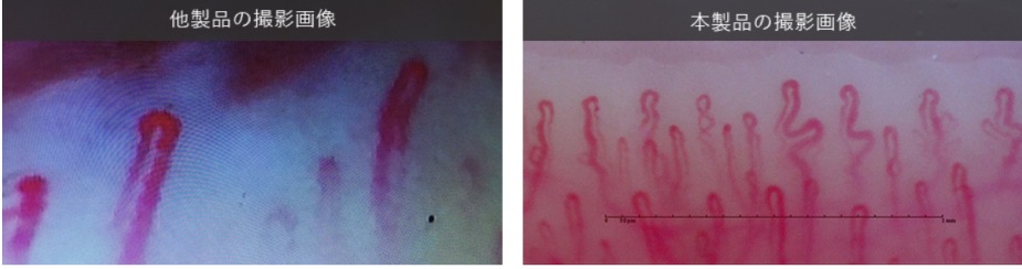 血流ドクターオート 3R-DRAUTO｜高速オートフォーカス搭載のハンディ血流観察機器｜高精細フルHD画質・約2秒で自動ピント調整｜軽量設計で省スペース・美容・健康カウンセリングに最適