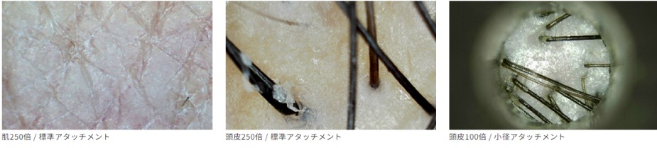 血流ドクターオート 3R-DRAUTO｜高速オートフォーカス搭載のハンディ血流観察機器｜高精細フルHD画質・約2秒で自動ピント調整｜軽量設計で省スペース・美容・健康カウンセリングに最適